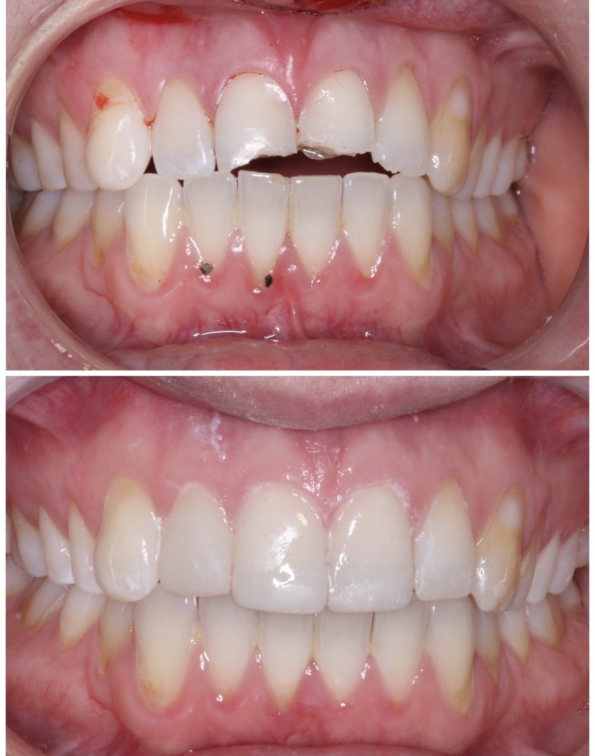 Emergency Fitzroy Dental