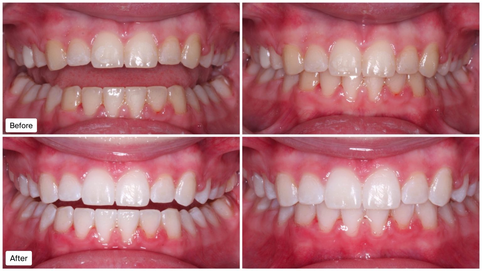 Smile Gallery Fitzroy Dental