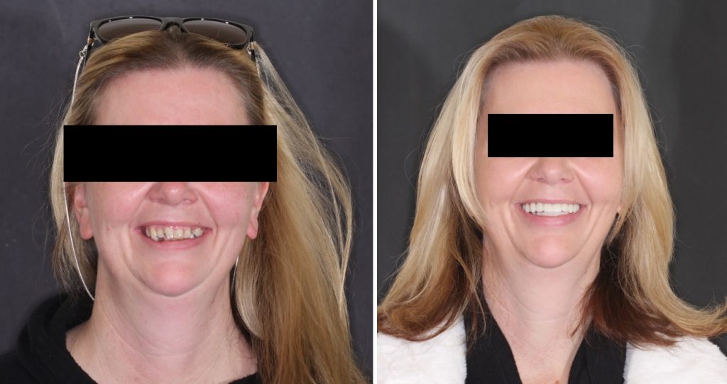 Smile Gallery Fitzroy Dental